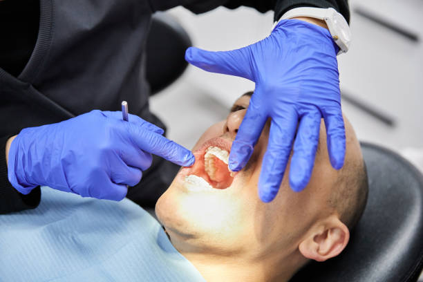 Best Root Canal Emergency Dentist  in Lemoore Station, CA